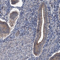 N4BP2L2 Antibody, Novus Biologicals 0.1mL; Unlabeled:Antibodies, Polyclonal